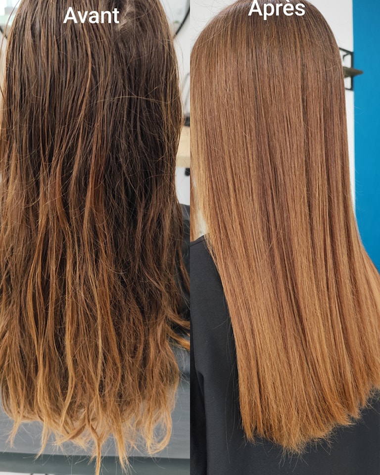 Botox Profond Ybera Paris à Cannes : le soin exclusif chez A More Beauty Salon